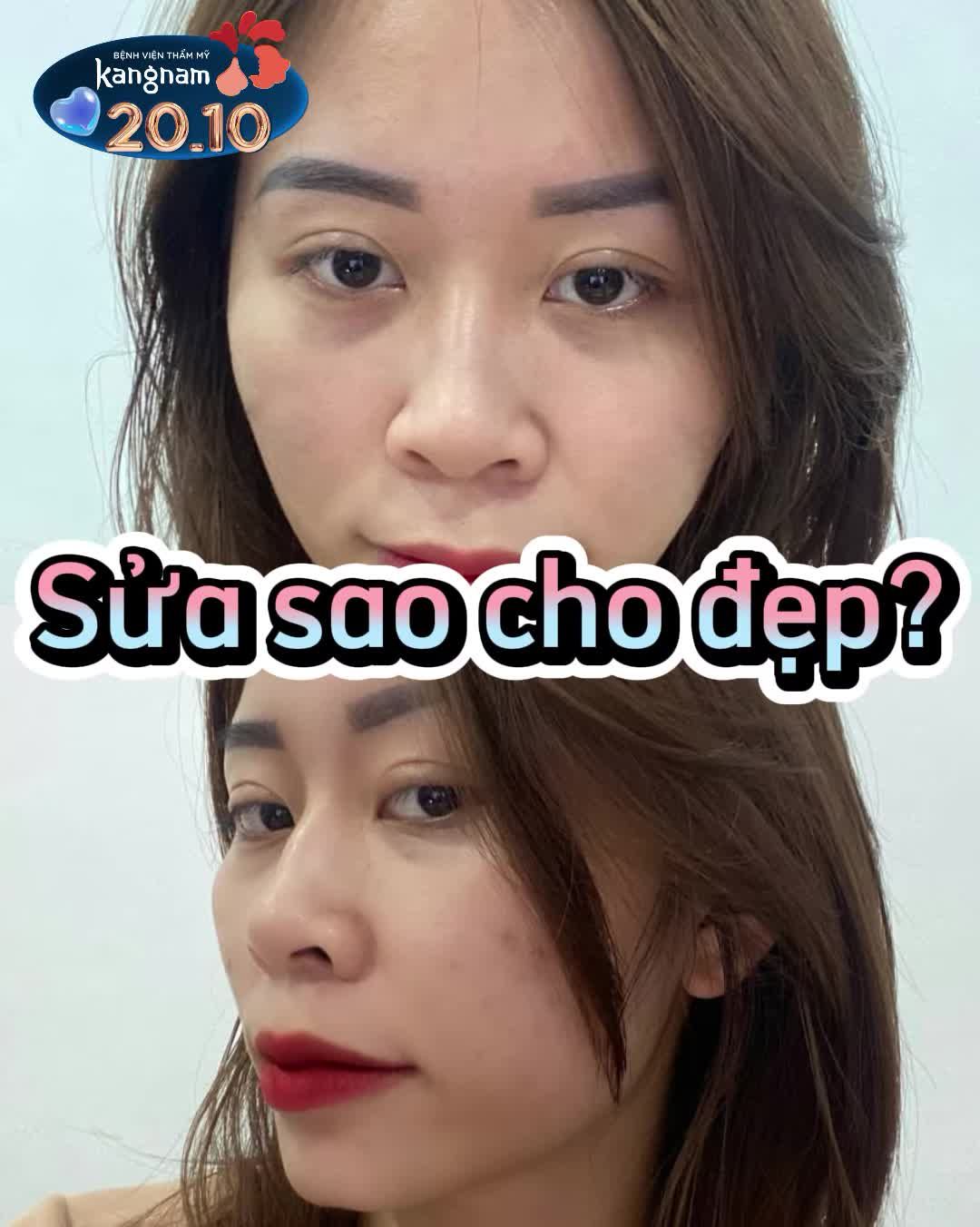 Bí quyết có mũi đep chuẩn Hot girl
