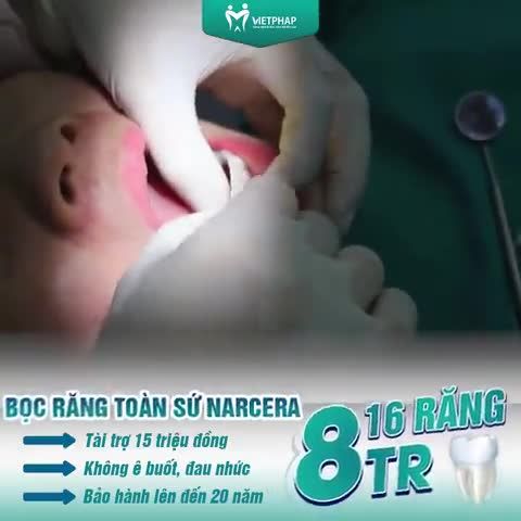 BỌC SỨ NACERA – GIẢI PHÁP ĐEM ĐẾN NỤ CƯỜI MỚI CHỈ VỚI 8 TRIỆU ĐỒNG