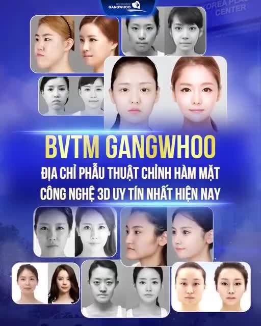 BVTM GANGWHOO - ĐẠI CHỈ CHỈNH HÀM MẶT UY TÍN - THẨM MỸ HÀNG ĐẦU HIỆN NAY