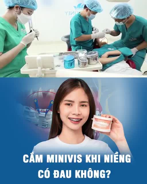Cắm minivis khi niềng có đau không