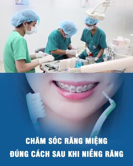 Chăm sóc răng miệng đúng cách sau khi niềng răng