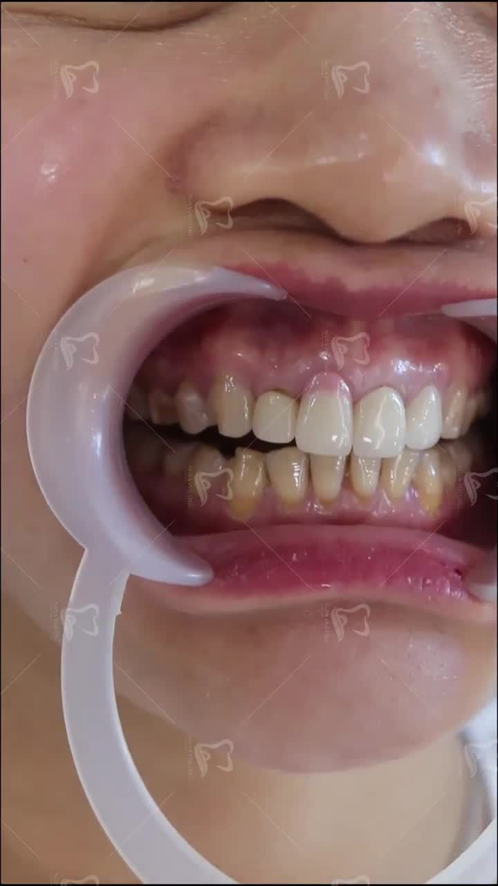 Cùng ngắm nhìn thành quả của chị khách dưới đây