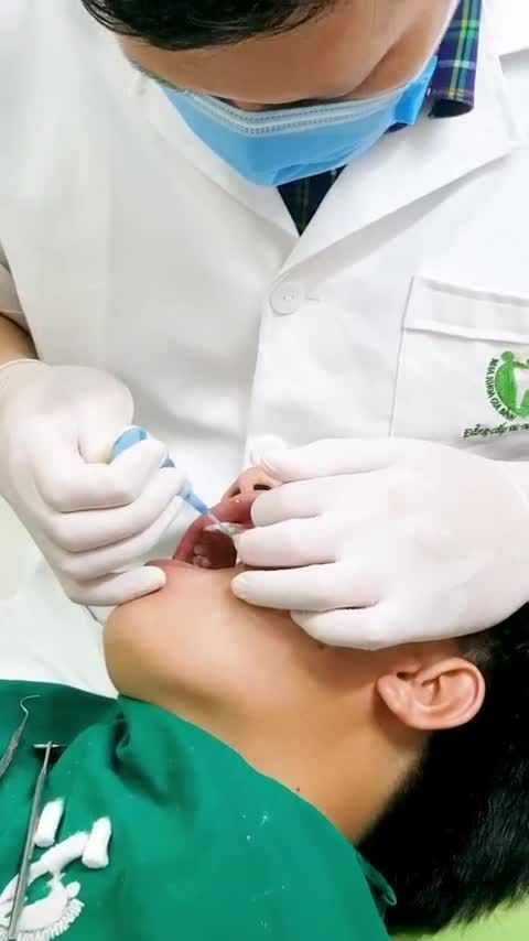 DÁN 20 VENEER SỨ CHO KHÁCH HÀNG TRƯƠNG VĂN THẮNG TẠI CS4 NHA KHOA GIA ĐÌNH