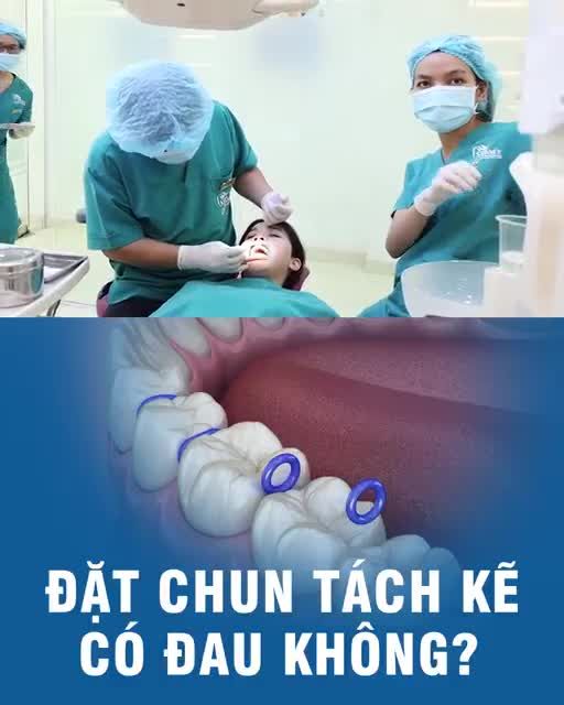 Đặt chun tách kẽ có đau không