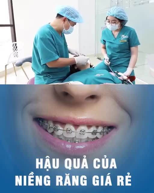 Hậu quả của niềng răng giá rẻ