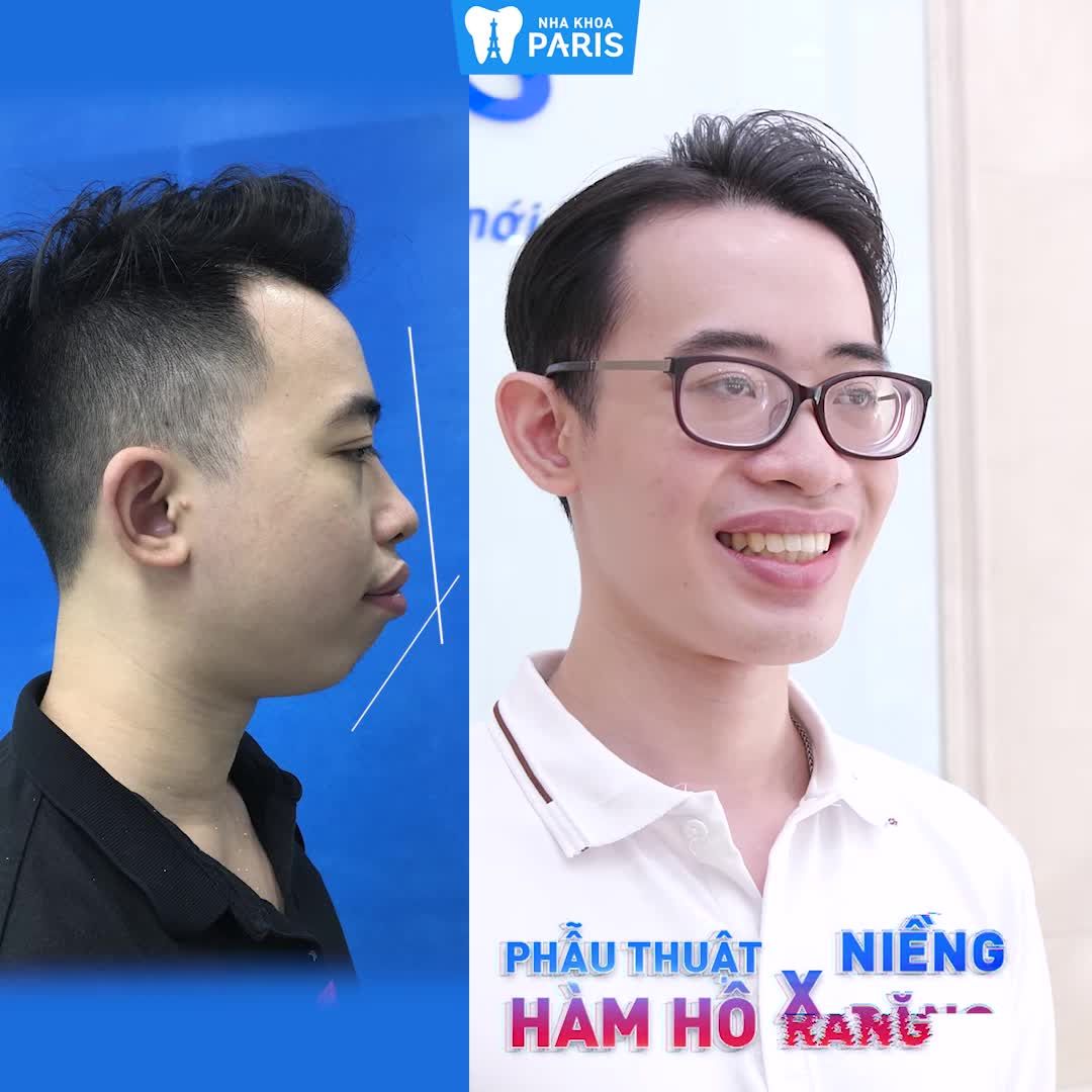 Khách hàng không nhận ra bản thân sau phẫu thuật