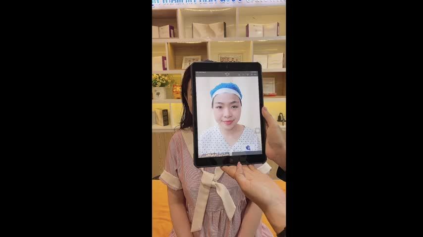 KHÁCH HÀNG SỞ HỮU CHIẾC MÁ LÚM XINH XINH CHO NỤ CƯỜI DUYÊN DÁNG