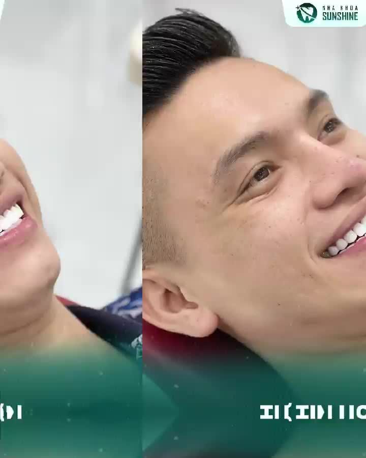 Không chỉ phái nữ mà phái nam làm răng sứ thẩm mỹ cũng trở thành  xu hướng làm đẹp hiện nay.