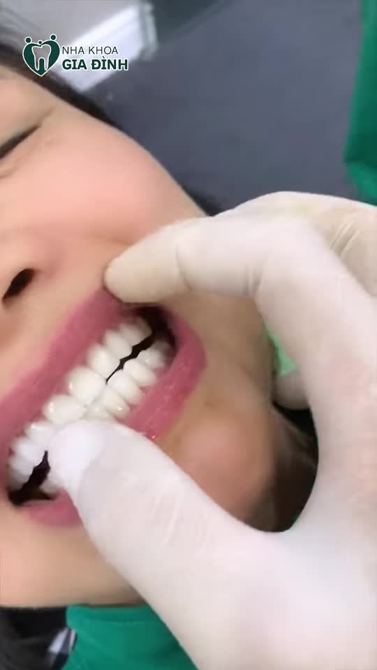 KIỆT TÁC ĐẾN TỪ ĐÔI BÀN TAY TÀI HOA CỦA BÁC SĨ GIÀU KINH NGHIỆM