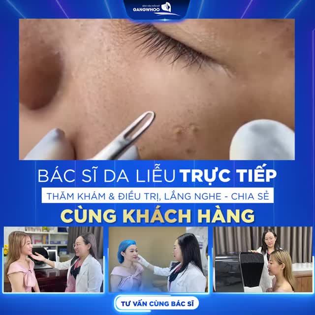 LIỆU TRÌNH ĐIỀU TRỊ MỤN CHUẨN Y KHOA - CÙNG BÁC SĨ DA LIỄU TẠI BVTM GANGWHOO
