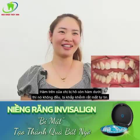 LỰA CHỌN INVISALIGN - HÔ BIẾN HÀM RĂNG HÔ, KHẤP KHỂNH NẶNG