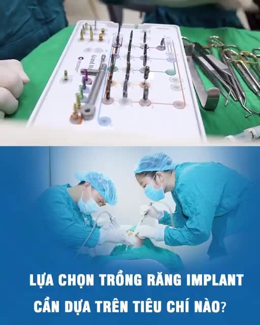 Lựa chọn trồng răng Implant cần dựa trên tiêu chí nào