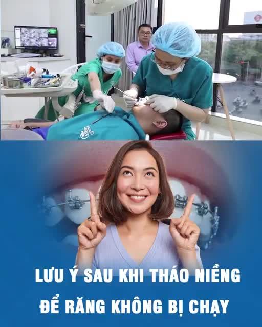 Lưu ý sau khi tháo niềng để răng không bị chạy