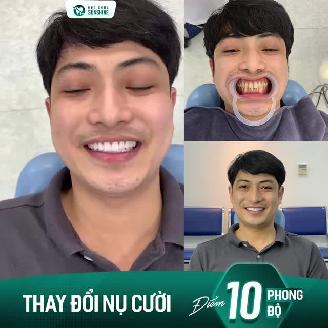 May mắn được biết đến Sunshine và giờ đây mình đã tự tin về nụ cười của mình hơn