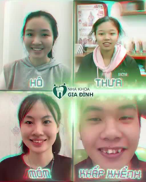 NIỀNG 1 LẦN ĐẸP TRỌN ĐỜI!!!