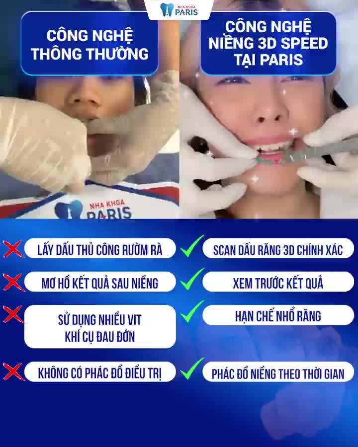 Niềng Răng Chọn Công Nghệ Cũ hay Mới