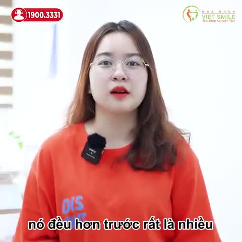NIỀNG RĂNG MẮC CÀI KIM LOẠI TỰ ĐỘNG - CẢI THIỆN RĂNG HÔ, CHEN CHÚC