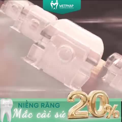 NIỀNG RĂNG MẮC CÀI SỨ - NGƯỜI ĐỀ CAO TÍNH THẨM MỸ KHÔNG THỂ BỎ QUA