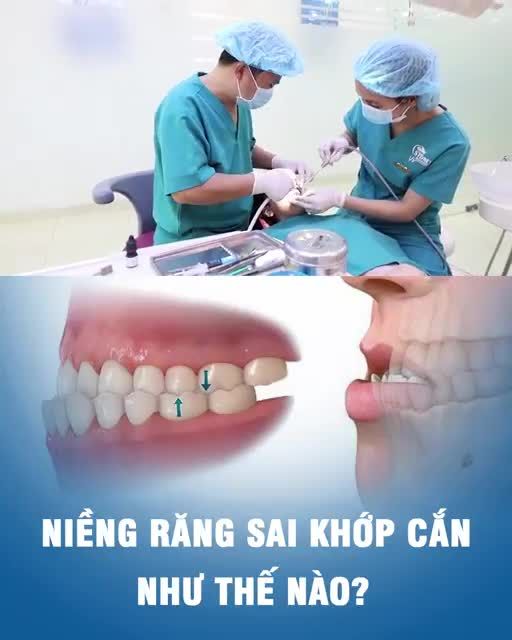 Niềng răng sai khớp cắn như thế nào