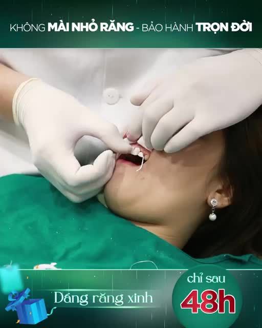 NỤ CƯỜI ĐẸP RẠNG NGỜI CHỈ SAU 48H