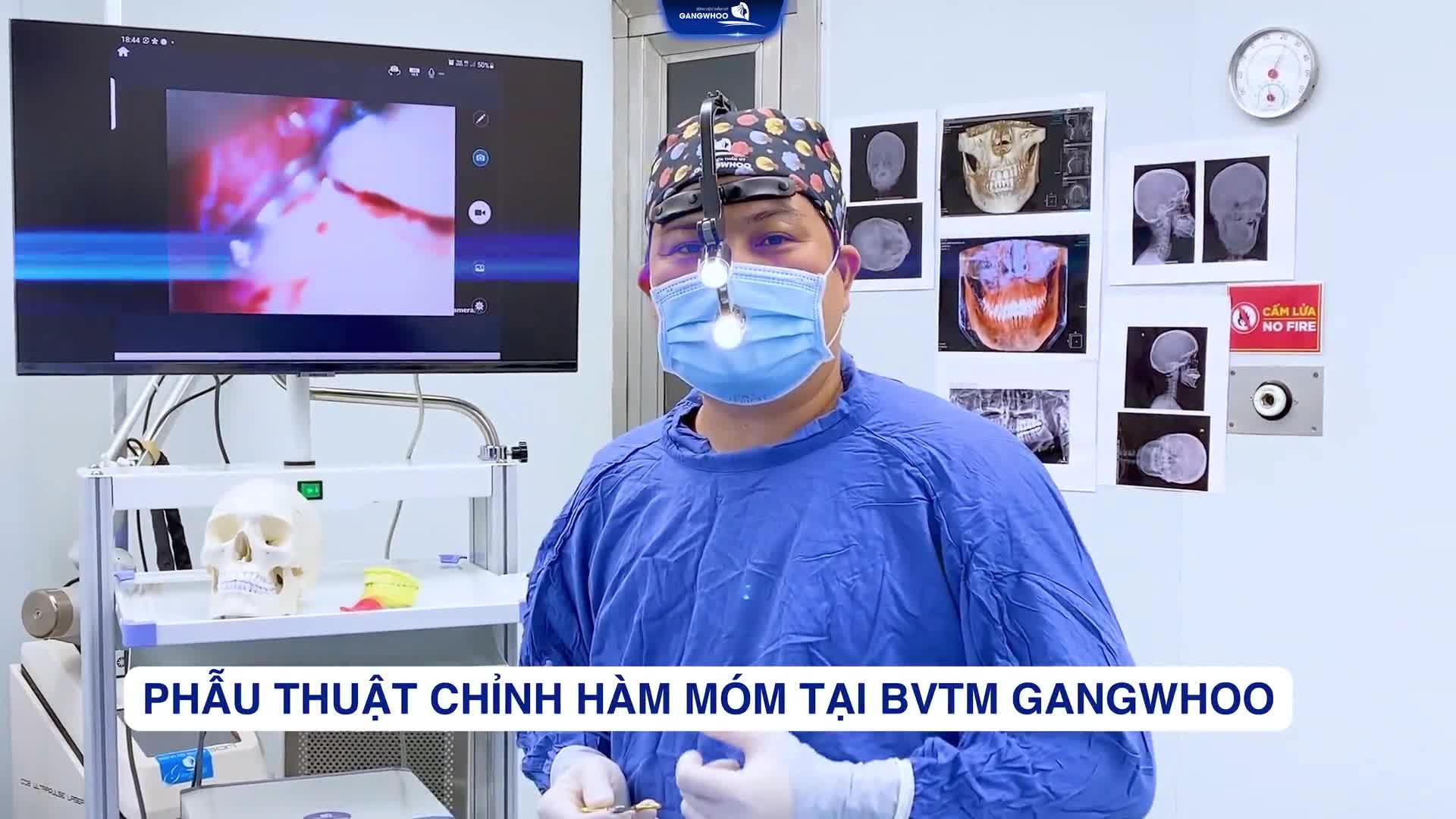 PHẪU THUẬT CHỈNH HÀM MÓM TẠI BVTM GANGWHOO