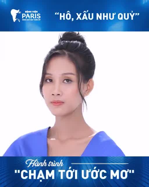 Phẫu thuật thẩm mỹ và phản ứng bất ngờ của gia đình... khi trở về