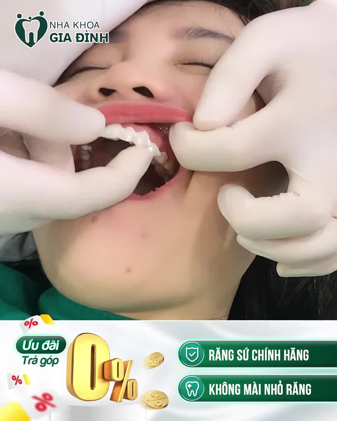 RẤT NHIỀU NHỮNG ƯU ĐÃI THÁNG NÀY CHỈ NHA KHOA GIA ĐÌNH MỚI CÓ