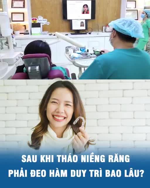 Sau khi tháo niềng răng phải đeo hàm duy trì bao lâu