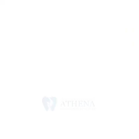 TẠM BIỆT RĂNG KHẤP KHỂNH NẶNG, MẤT CÂN ĐỐI CHỈ SAU 2 NĂM TẠI NHA KHOA ATHENA