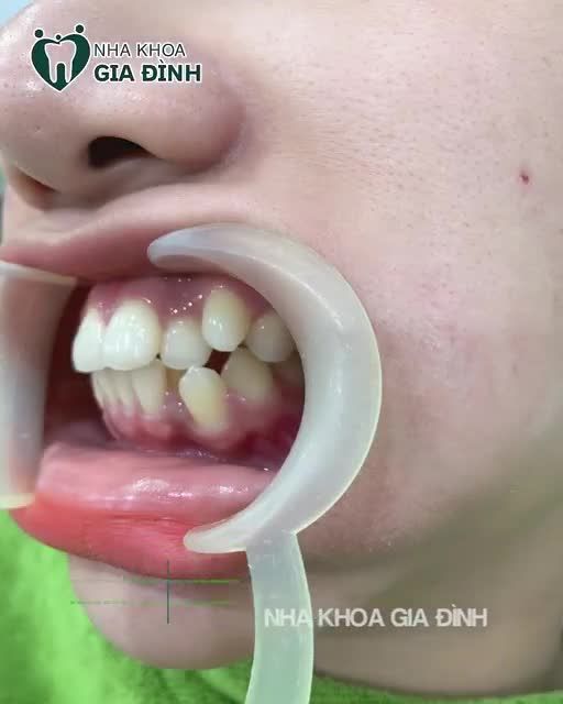 THAY ĐỔI ĐỂ TRỞ THÀNH PHIÊN BẢN TỐT HƠN CỦA CHÍNH MÌNH