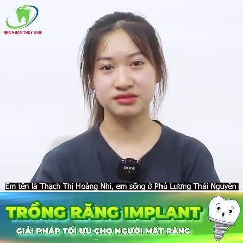 TRỒNG IMPLANT - GIẢI PHÁP THAY THẾ RĂNG SÂU HỎNG KHÔNG THỂ ĐIỀU TRỊ BẢO TỒN