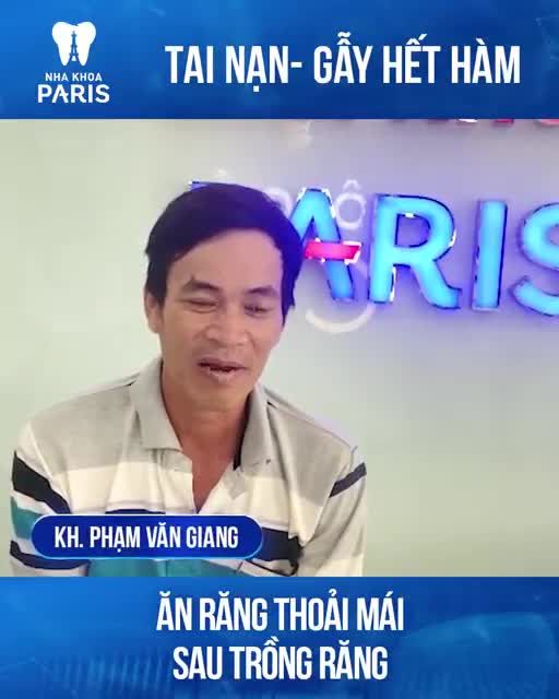 TRỒNG RĂNG TOÀN HÀM KẾT QUẢ THẾ NÀO