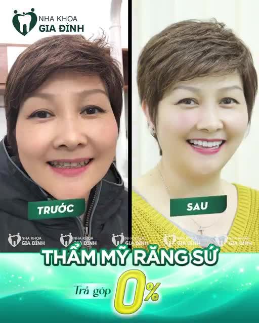 VIỆT KIỀU ĐỨC TIN TƯỞNG CHỌN NHA KHOA GIA ĐÌNH LÀM RĂNG SỨ THẨM MỸ