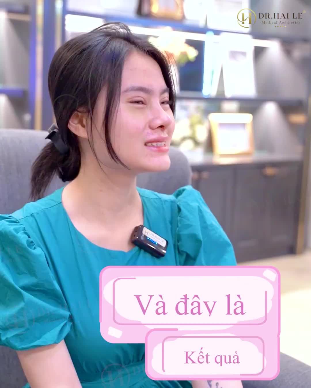 Cả nhà có nhận ra đây là một người không ạ  "Biến hình" girl xinh nhờ Combo nâng mũi & Cắt mí là có thật.