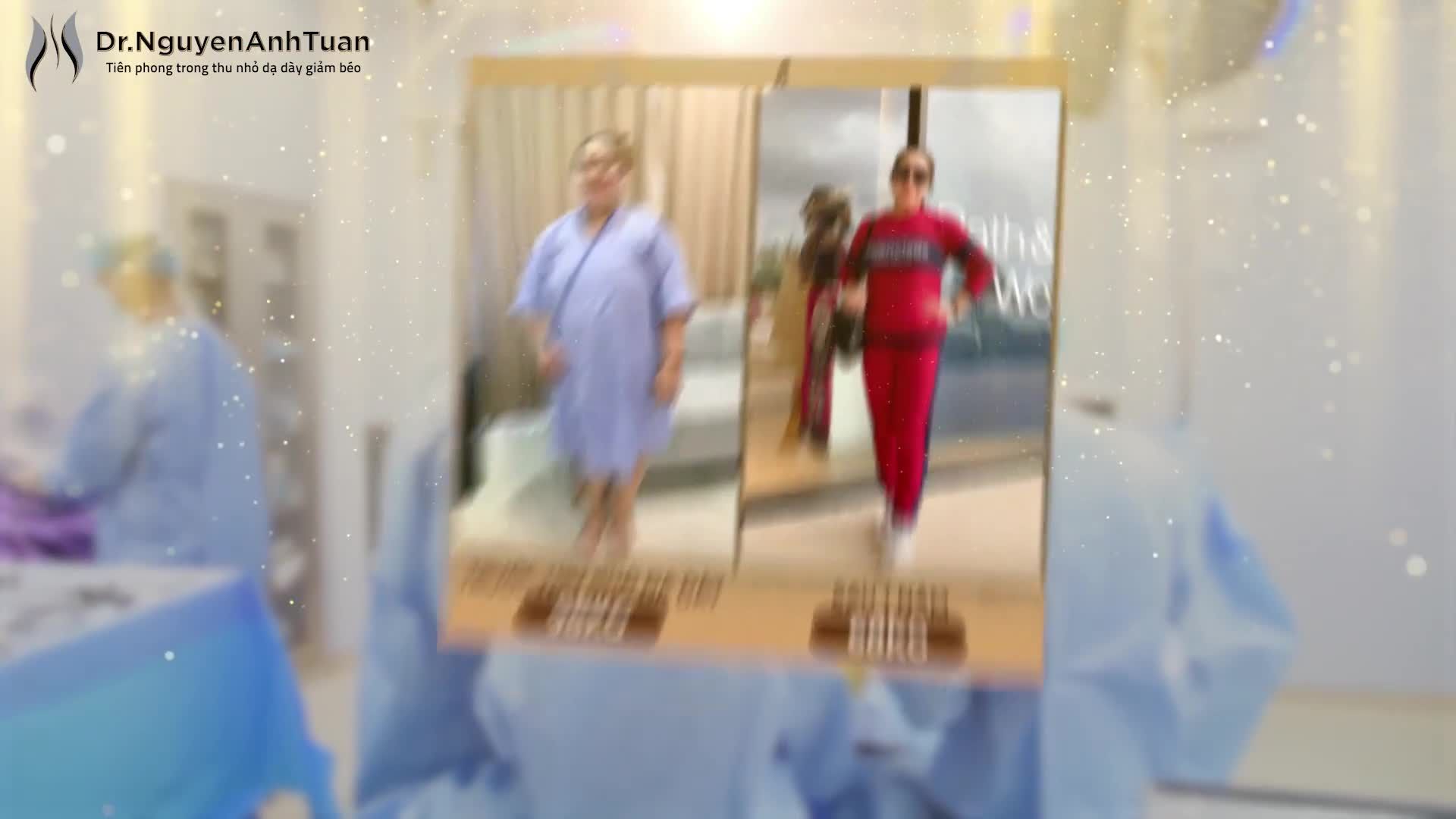 Bạn đang tìm hiểu về phương pháp phẫu thuật nội soi thu nhỏ dạ dày giảm cân