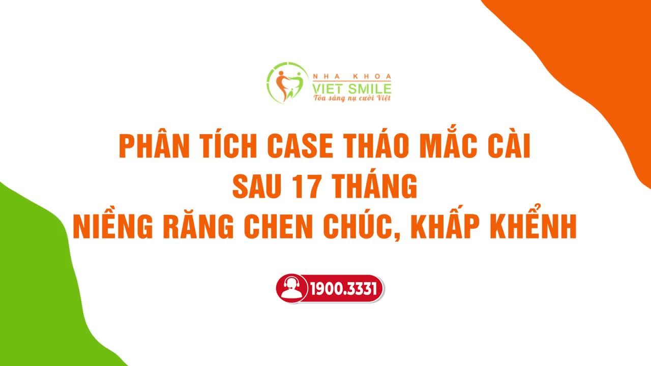 PHÂN TÍCH KẾT QUẢ NIỀNG RĂNG CHEN CHÚC SAU 17 THÁNG