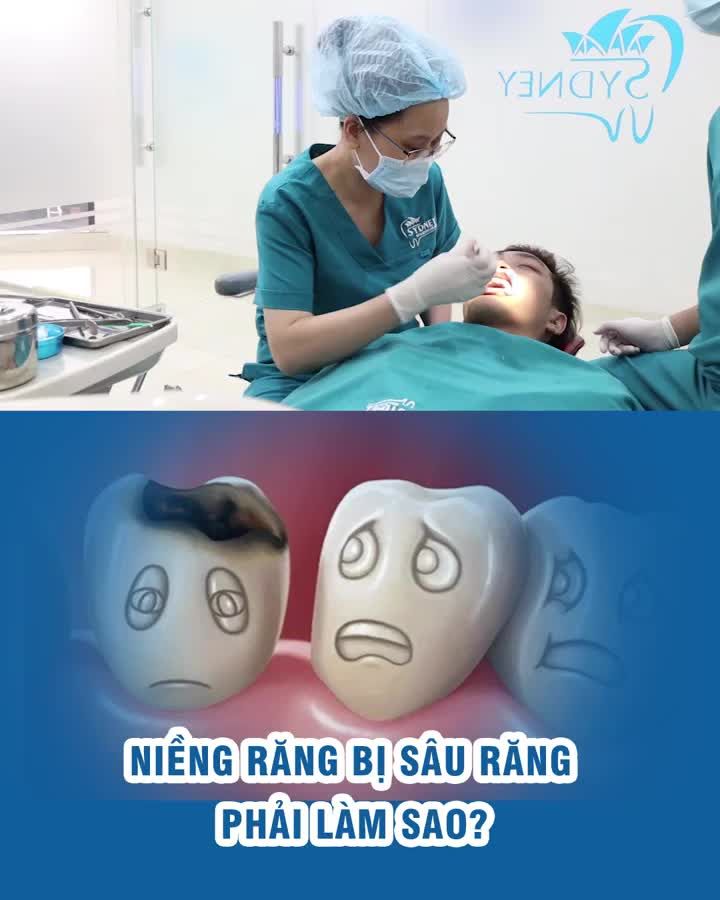 Niềng răng bị sâu răng phải làm sao?
