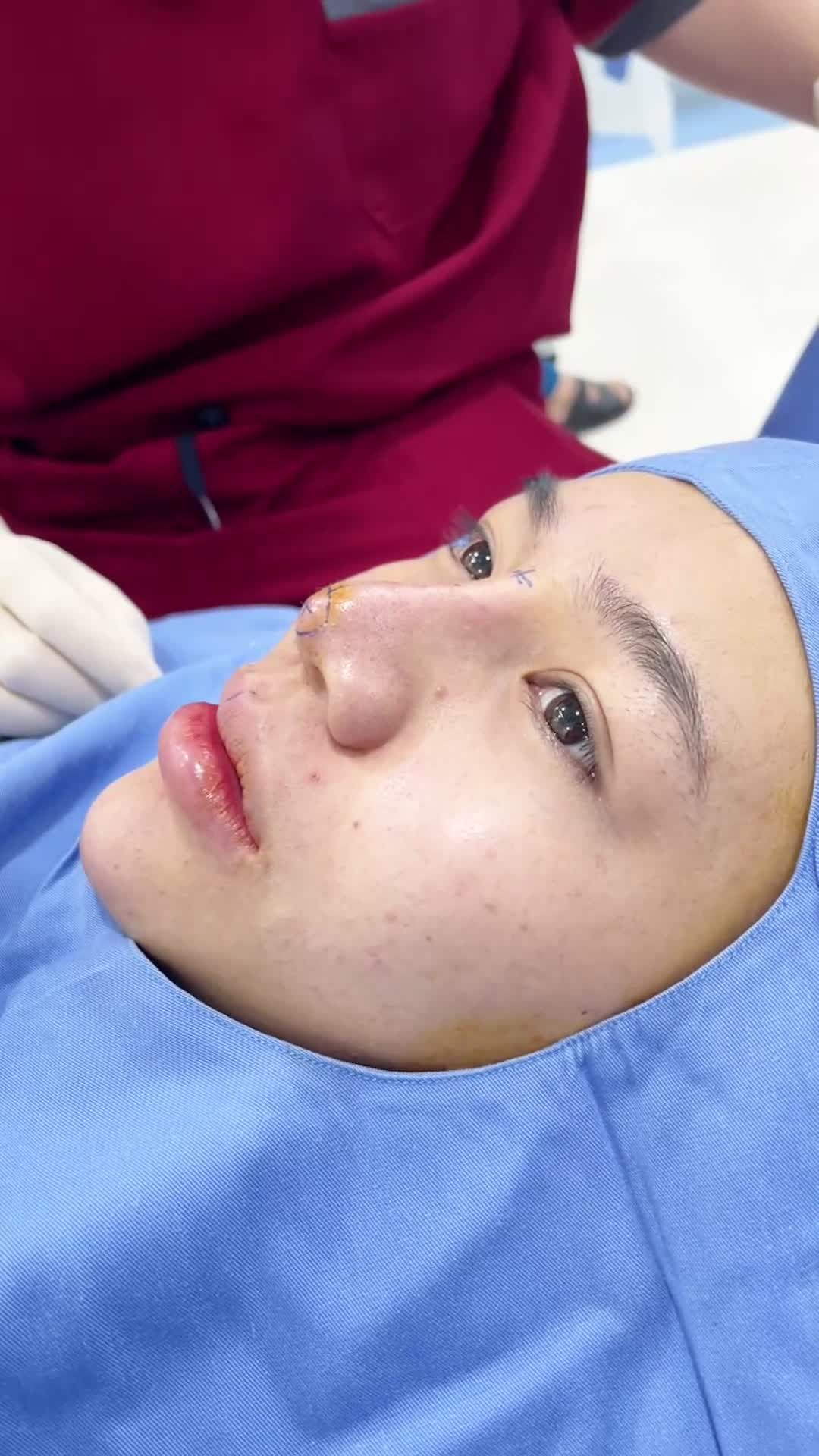 Mũi hỏng - Tới Kangnam sửa mũi!