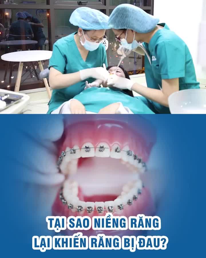 Tại sao niềng răng lại khiến răng bị đau?