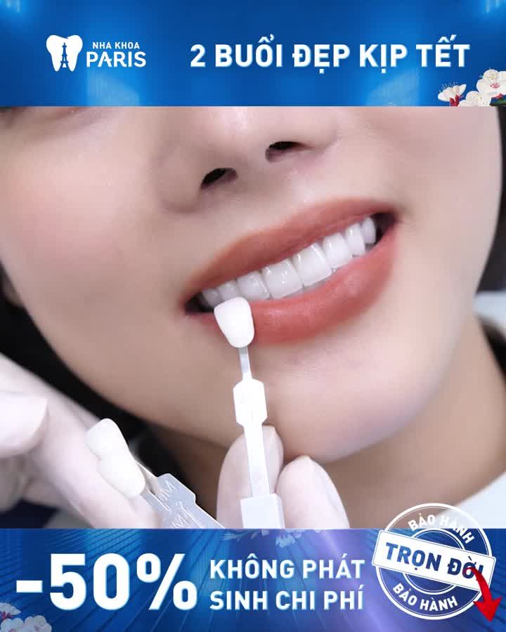 Siêu phẩm răng sứ đẹp "Ngây Ngất"