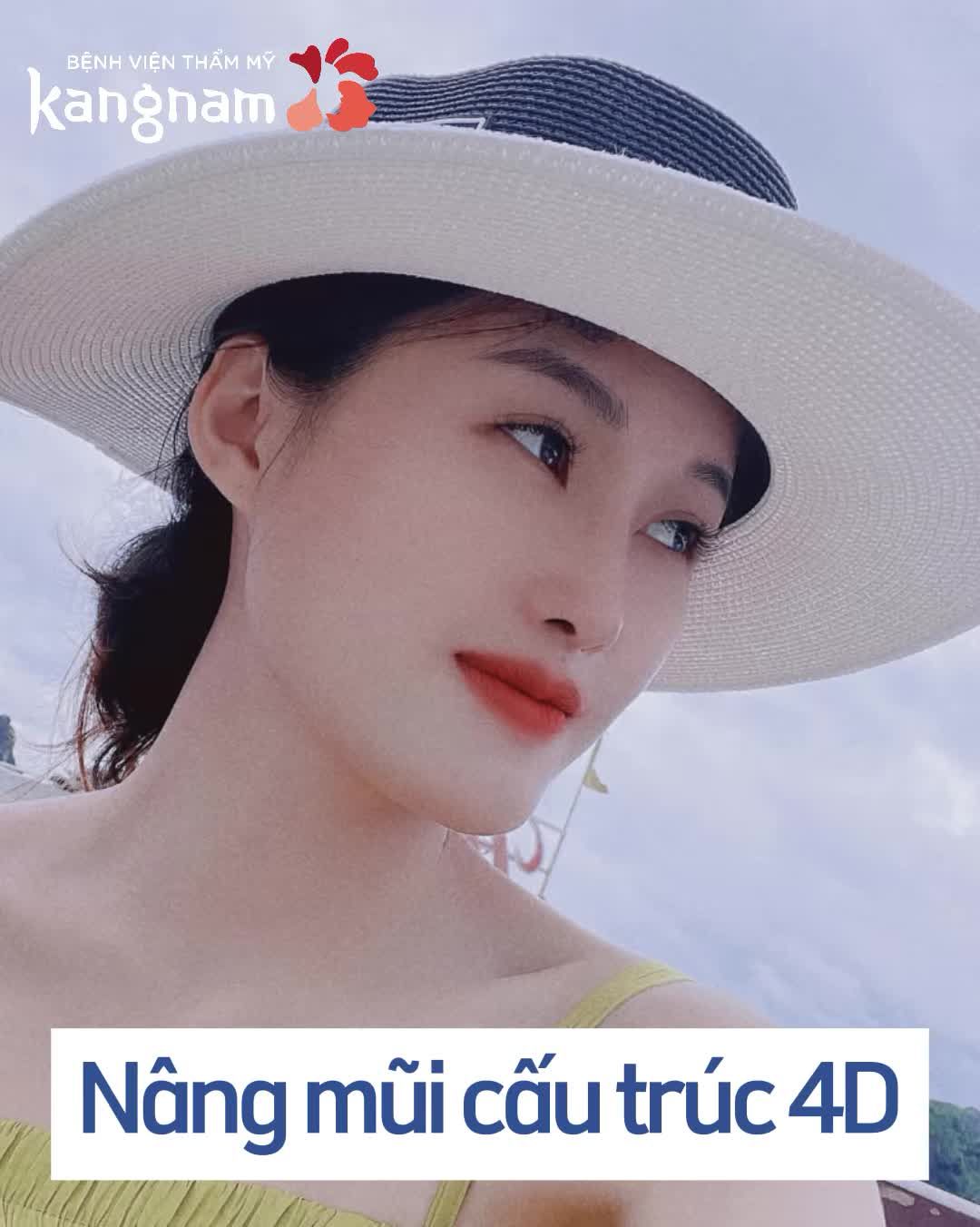 Cô ấy đã thay đổi như thế nào sau nâng mũi cấu trúc 4D