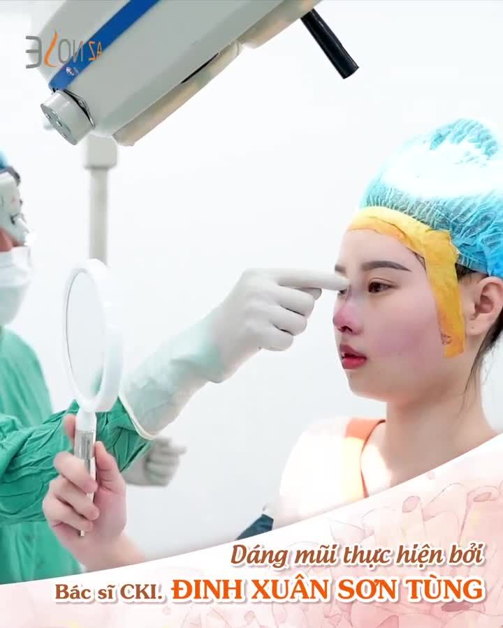 Nàng 2K2 trẻ trung với dáng mũi Sline tự nhiên