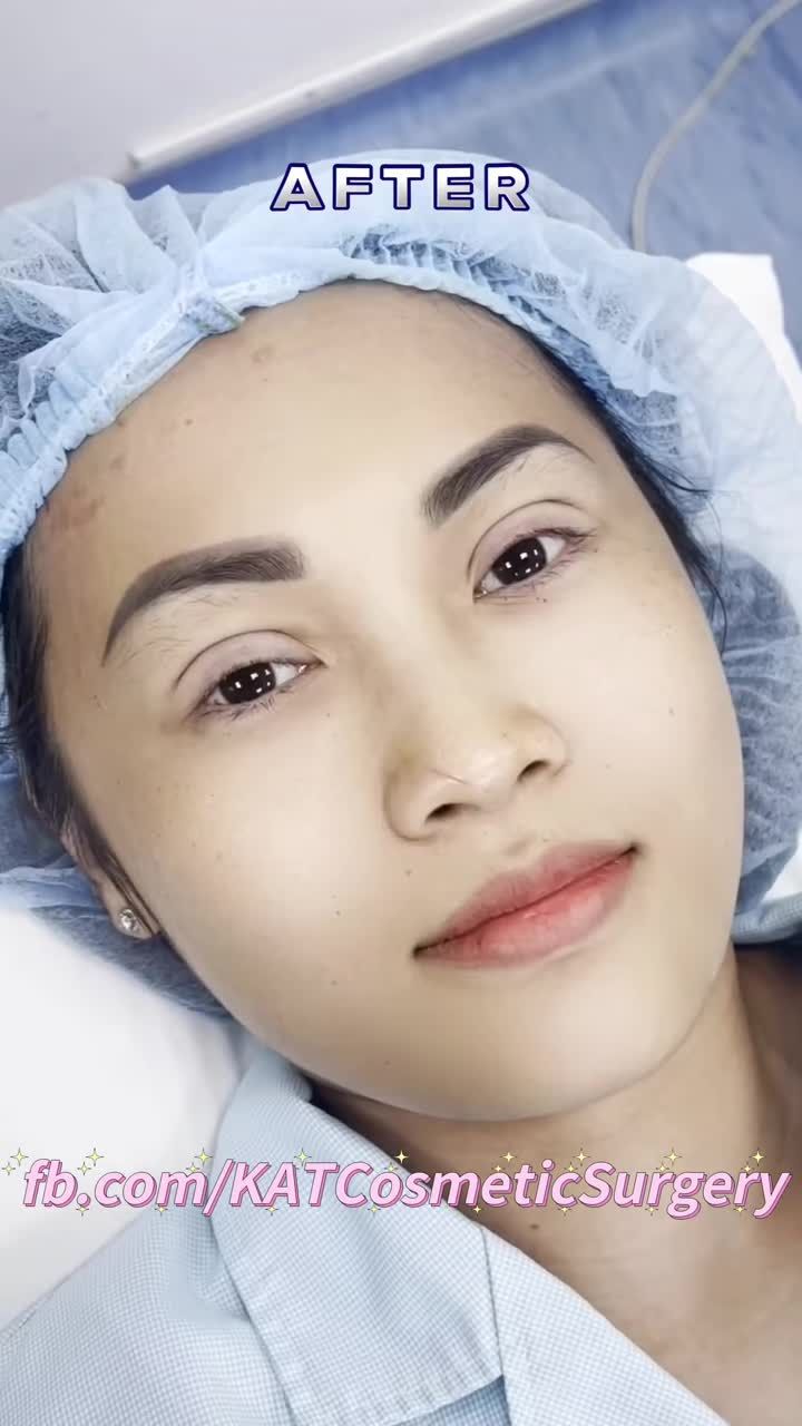 “ Đôi mắt long lanh chỉ sau 15 phút’ “