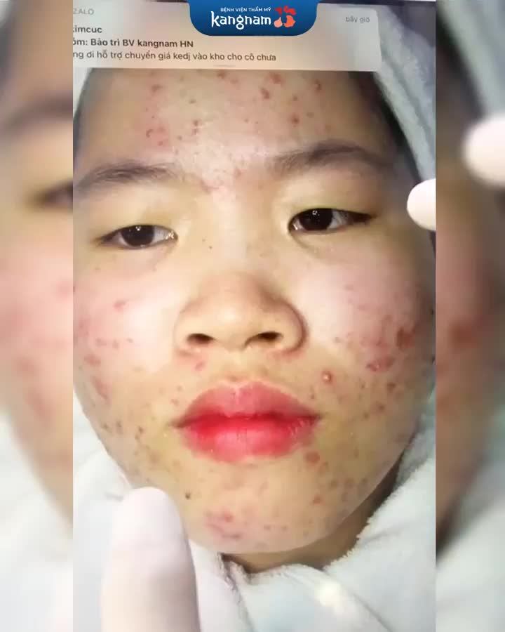 Cả nhà chuẩn bị tinh thần dự event sinh nhật Kangnam chưa ạ??