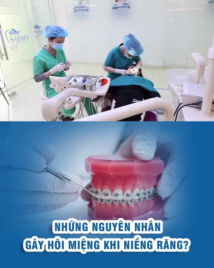 Những nguyên nhân gây hôi miệng khi niềng răng