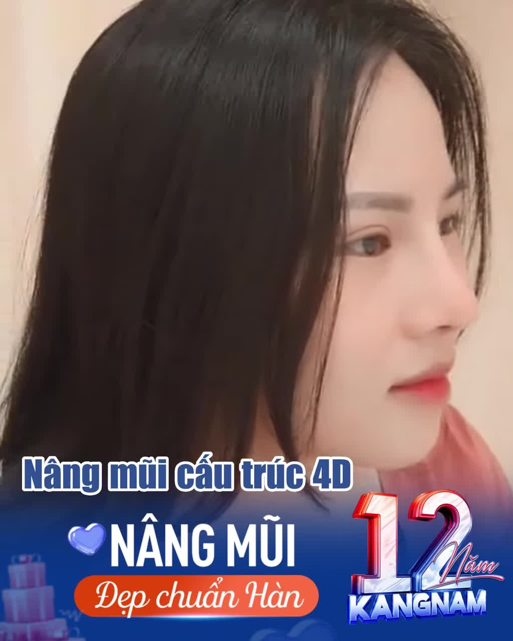 Muốn xinh thế này chỉ cần nâng mũi là xong