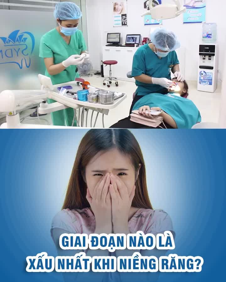 Giai đoạn xấu nhất khi niềng răng?