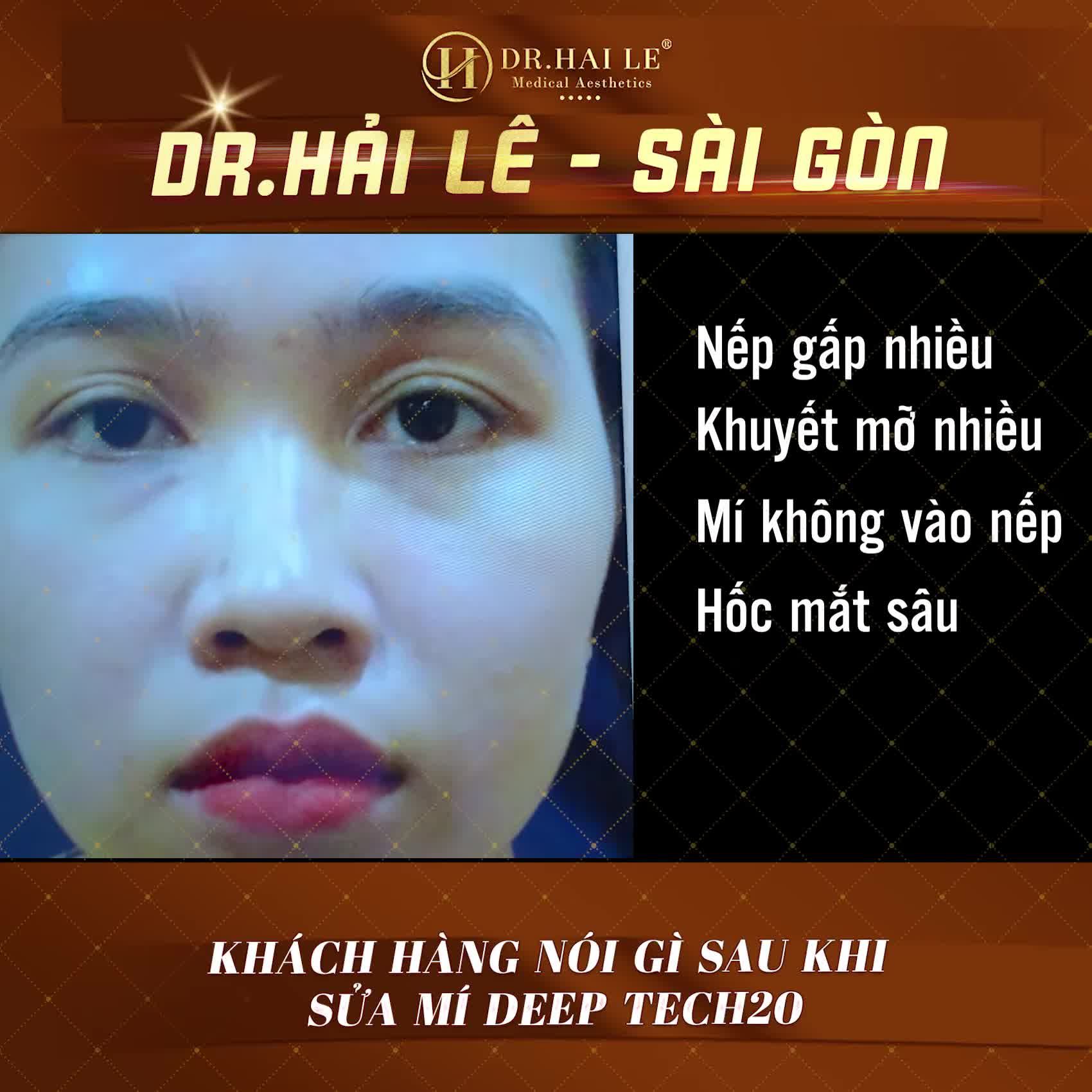 Đặt hết niềm tin vào Bác sĩ Hải Lê và kết quả.....HÀI LÒNG VÔ CÙNG