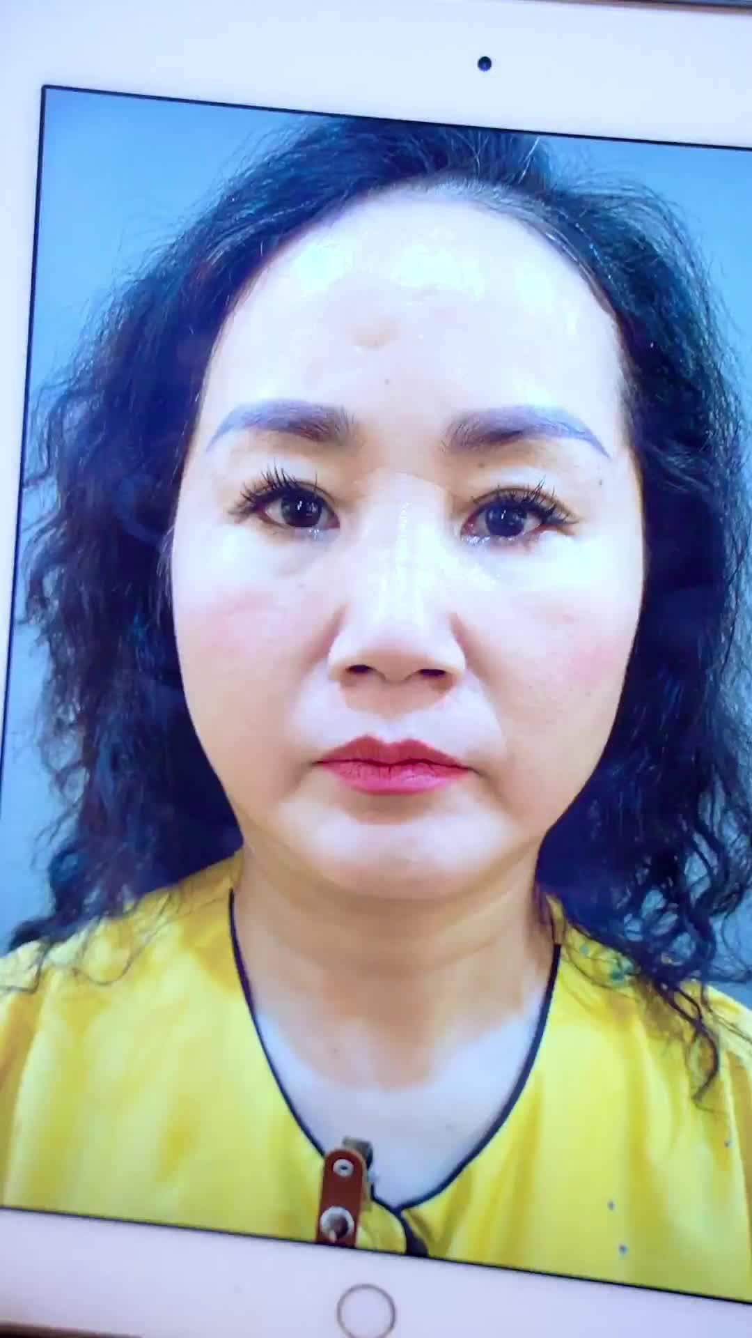 Lí do khách hàng yêu thích độn cằm tại Dr.Hải Lê. Đừng bỏ lỡ!
