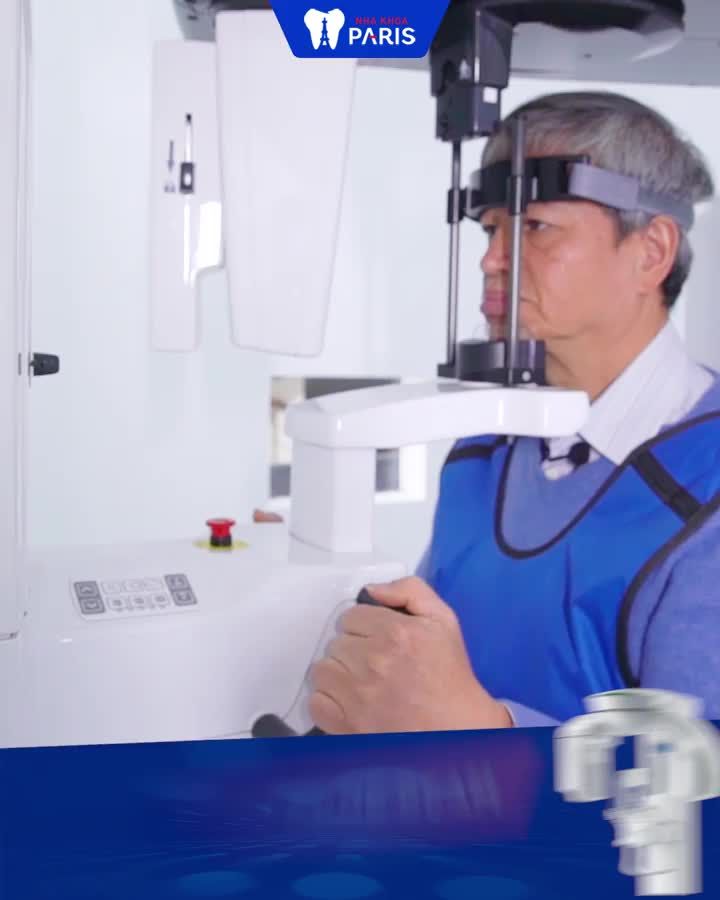 TRỒNG RĂNG CÔNG NGHỆ 4S BỀN 40 NĂM